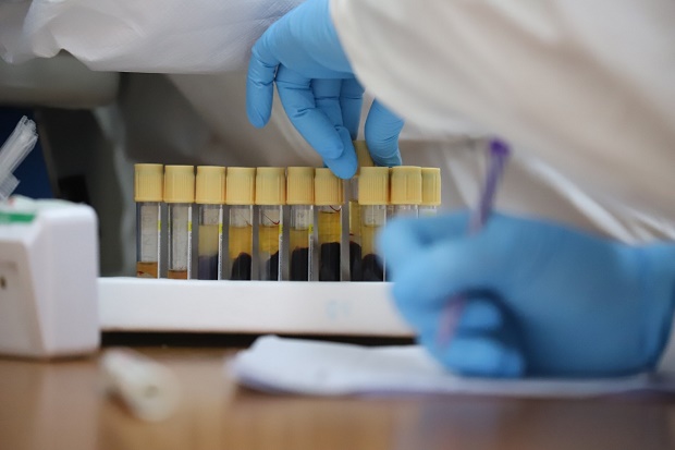 Peneliti Unair Sebut Obat COVID-19 Dapat Sembuhkan Pasien hingga 90%