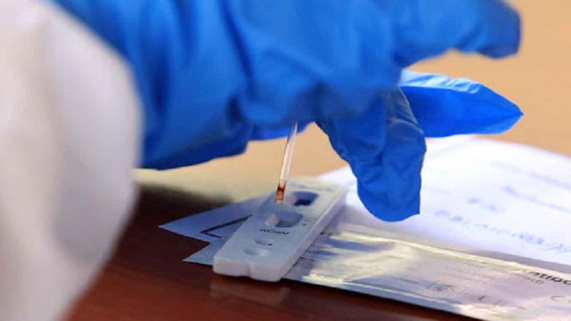 Dinkes Batam Tes PCR Keluarga yang Jemput Paksa Jenazah Positif Covid-19